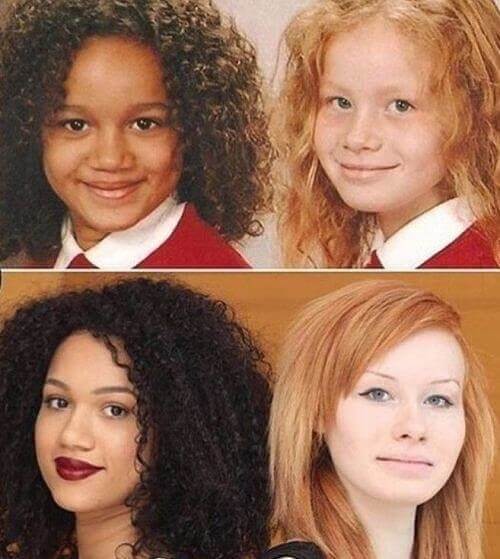 These Twins Who Born To Biracial Parents