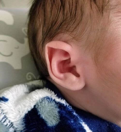 Baby With Elf Ears