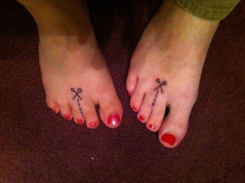 This Woman Was Born With Syndactyly Connected Toes